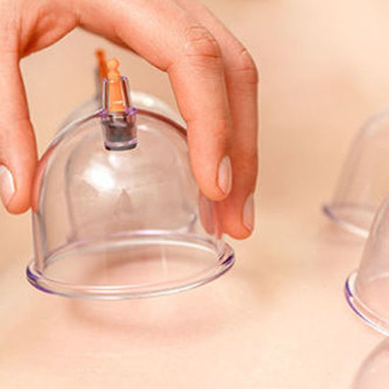 Bild von Schröpfen/Schröpfmassage am Rücken | 20 Min.